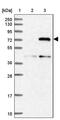 Fermitin Family Member 2 antibody, PA5-59200, Invitrogen Antibodies, Western Blot image 