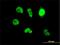 Zinc Finger BED-Type Containing 1 antibody, H00009189-M01, Novus Biologicals, Immunocytochemistry image 