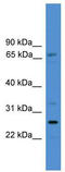 Solute carrier family 13 member 3 antibody, TA346062, Origene, Western Blot image 