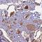 Angiopoietin Like 2 antibody, HPA041299, Atlas Antibodies, Immunohistochemistry frozen image 