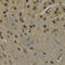 Leucine-rich glioma-inactivated protein 1 antibody, A5408, ABclonal Technology, Immunohistochemistry paraffin image 