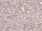 Colorectal Cancer Associated 1 antibody, 204492-T08, Sino Biological, Immunohistochemistry paraffin image 