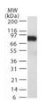 ANTXR Cell Adhesion Molecule 1 antibody, GTX13798, GeneTex, Western Blot image 