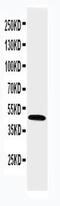 Hydroxysteroid 17-Beta Dehydrogenase 2 antibody, PA5-79403, Invitrogen Antibodies, Western Blot image 