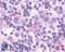 C-C Motif Chemokine Receptor 9 antibody, LS-A958, Lifespan Biosciences, Immunohistochemistry frozen image 