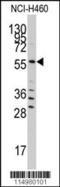 SARS antibody, 63-225, ProSci Inc, Western Blot image 