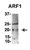 Arf-GAP with GTPase, ANK repeat and PH domain-containing protein 2 antibody, orb77510, Biorbyt, Immunoprecipitation image 