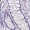 Myomesin-1 antibody, PA5-61907, Invitrogen Antibodies, Immunohistochemistry paraffin image 