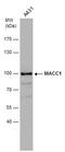 MET Transcriptional Regulator MACC1 antibody, GTX131332, GeneTex, Western Blot image 