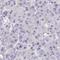 Kelch Repeat And BTB Domain Containing 13 antibody, HPA062737, Atlas Antibodies, Immunohistochemistry paraffin image 