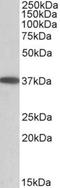 Monoacylglycerol O-Acyltransferase 2 antibody, NBP1-52078, Novus Biologicals, Western Blot image 