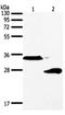 Surfactant Protein A1 antibody, orb107608, Biorbyt, Western Blot image 
