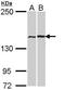 FA Complementation Group A antibody, TA308599, Origene, Western Blot image 