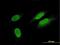 Titin antibody, H00007273-M09, Novus Biologicals, Immunocytochemistry image 