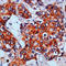 BCAR1 Scaffold Protein, Cas Family Member antibody, LS-C88519, Lifespan Biosciences, Immunohistochemistry paraffin image 