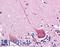 DLG Associated Protein 2 antibody, LS-B4593, Lifespan Biosciences, Immunohistochemistry paraffin image 