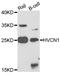 HVCN1 antibody, LS-B15536, Lifespan Biosciences, Western Blot image 