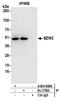 Basic Leucine Zipper And W2 Domains 2 antibody, A304-608A, Bethyl Labs, Immunoprecipitation image 