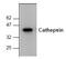 Cathepsin K antibody, AP00124PU-N, Origene, Western Blot image 