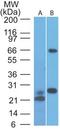 Mitochondrial Antiviral Signaling Protein antibody, TA336939, Origene, Western Blot image 