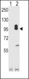 cGMP-dependent protein kinase 2 antibody, PA5-15223, Invitrogen Antibodies, Western Blot image 