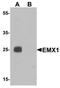 Homeobox protein EMX1 antibody, orb75704, Biorbyt, Western Blot image 