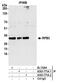 RNA Polymerase II Subunit C antibody, A303-771A, Bethyl Labs, Immunoprecipitation image 