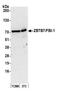 Zinc Finger And BTB Domain Containing 7A antibody, A300-548A, Bethyl Labs, Western Blot image 