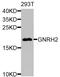 Gonadotropin Releasing Hormone 2 antibody, A8424, ABclonal Technology, Western Blot image 