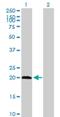 Phosphopantothenoylcysteine Decarboxylase antibody, H00060490-B01P, Novus Biologicals, Western Blot image 