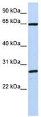 DnaJ Heat Shock Protein Family (Hsp40) Member C1 antibody, TA338600, Origene, Western Blot image 