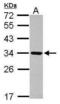 Exosome Component 2 antibody, PA5-30972, Invitrogen Antibodies, Western Blot image 