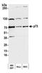 Tumor Protein P73 antibody, A300-126A, Bethyl Labs, Western Blot image 