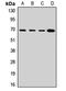 P2X purinoceptor 7 antibody, orb411794, Biorbyt, Western Blot image 
