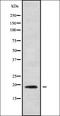 Interleukin 36 Gamma antibody, orb336298, Biorbyt, Western Blot image 