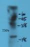 Sonic Hedgehog Signaling Molecule antibody, orb11368, Biorbyt, Western Blot image 