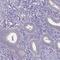 Spectrin Beta, Non-Erythrocytic 2 antibody, HPA043529, Atlas Antibodies, Immunohistochemistry paraffin image 