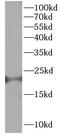 LIM Domain Only 4 antibody, FNab10023, FineTest, Western Blot image 