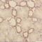 Carbonic Anhydrase 9 antibody, FNab01167, FineTest, Immunohistochemistry frozen image 
