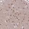 Stromal Interaction Molecule 2 antibody, HPA036933, Atlas Antibodies, Immunohistochemistry frozen image 