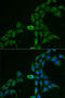 DEAD-Box Helicase 1 antibody, 22-324, ProSci, Immunofluorescence image 