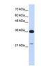 TP53 Target 5 antibody, NBP1-58924, Novus Biologicals, Western Blot image 