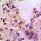 Cytochrome P450 Family 39 Subfamily A Member 1 antibody, LS-C353430, Lifespan Biosciences, Immunohistochemistry paraffin image 