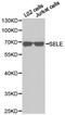 Selectin E antibody, LS-C192899, Lifespan Biosciences, Western Blot image 