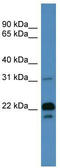 Brain Abundant Membrane Attached Signal Protein 1 antibody, TA342783, Origene, Western Blot image 