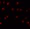 Zinc Finger Protein 281 antibody, A07538, Boster Biological Technology, Immunofluorescence image 