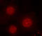 Forkhead Box O4 antibody, LS-C335844, Lifespan Biosciences, Immunofluorescence image 