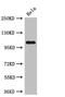 Ubiquitin Specific Peptidase 33 antibody, CSB-PA840583LA01HU, Cusabio, Western Blot image 
