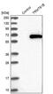 TRNA Methyltransferase 61B antibody, PA5-55402, Invitrogen Antibodies, Western Blot image 