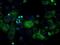 ATP Synthase F1 Subunit Beta antibody, NBP2-02249, Novus Biologicals, Immunocytochemistry image 